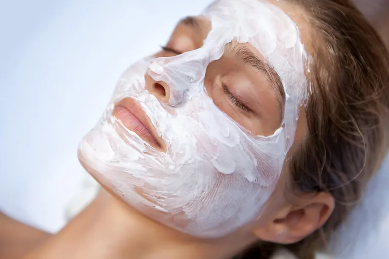Kemisk peeling
